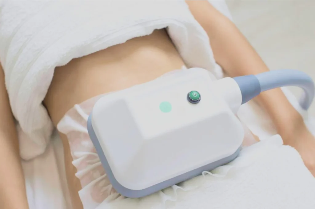 How Fat Freezing and HIFU Work Together? 3 advantages to combining Fat Freezing and HIFU Feltham