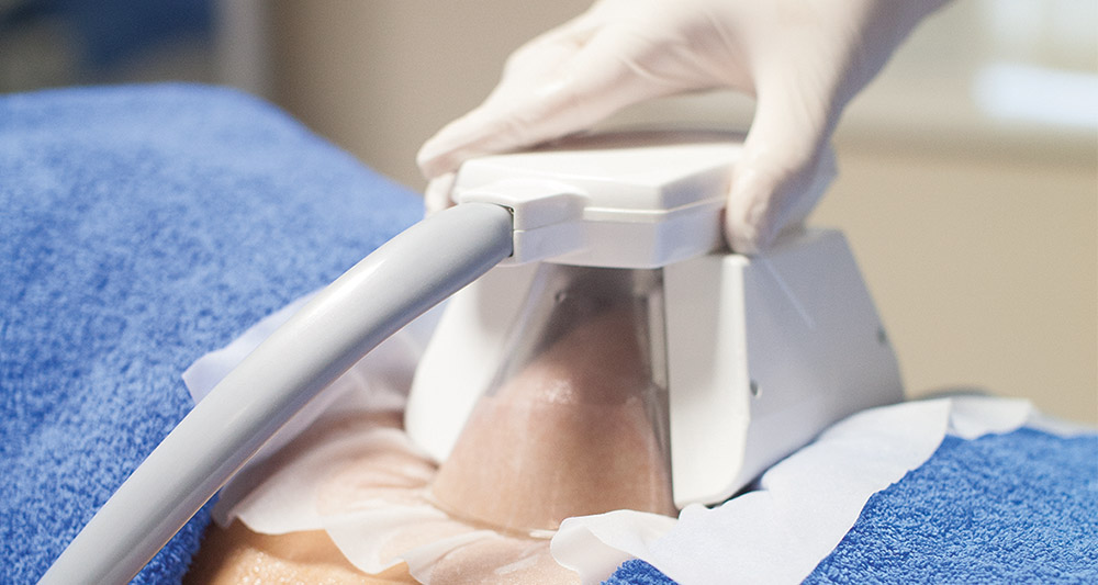 How Fat Freezing and HIFU Work Together? 2 Multiple Areas in One Session HIFU and Fat Freezing Feltham