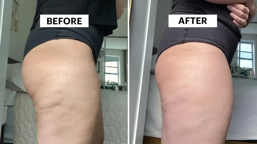 Do Toning Exercise Feltham Really Tackle Cellulite?