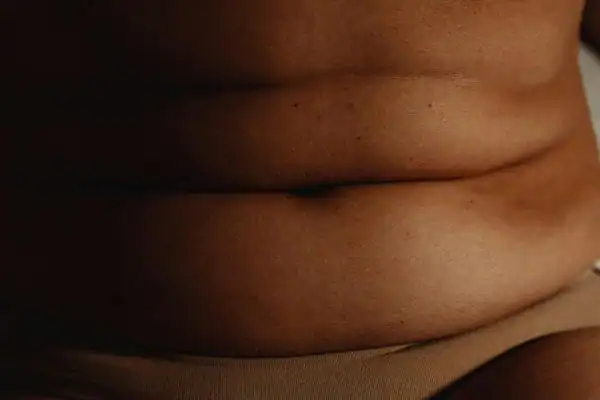The Hidden Connection: How Stress Shapes Your Fitness and Body Composition 3 image of what stress can do on the stomach area and how Lipo 360 Feltham can help to change your body shape.