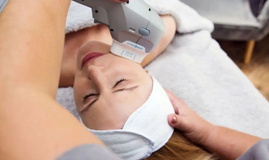 Discover the Perfect Duo: RF Microneedling and HIFU 1 Image of Morpheus8 And HIFU Feltham combined treatment